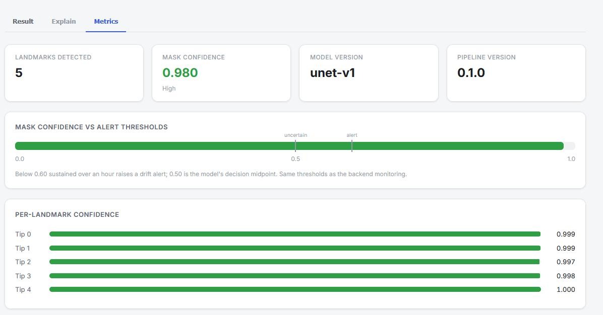 The researcher UI’s metrics tab: five landmarks detected, mask confidence 0.980, model version unet-v1, and per-landmark confidence between 0.997 and 1.000, with the drift-alert threshold marked on the confidence scale.